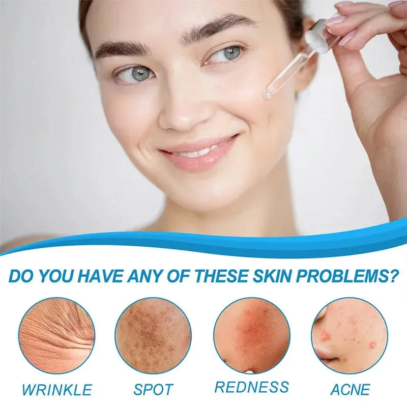 Woman applying serum from dropper to face with skin concern icons