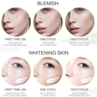 Whitening skin cream with applicator shown on face for blemish treatment