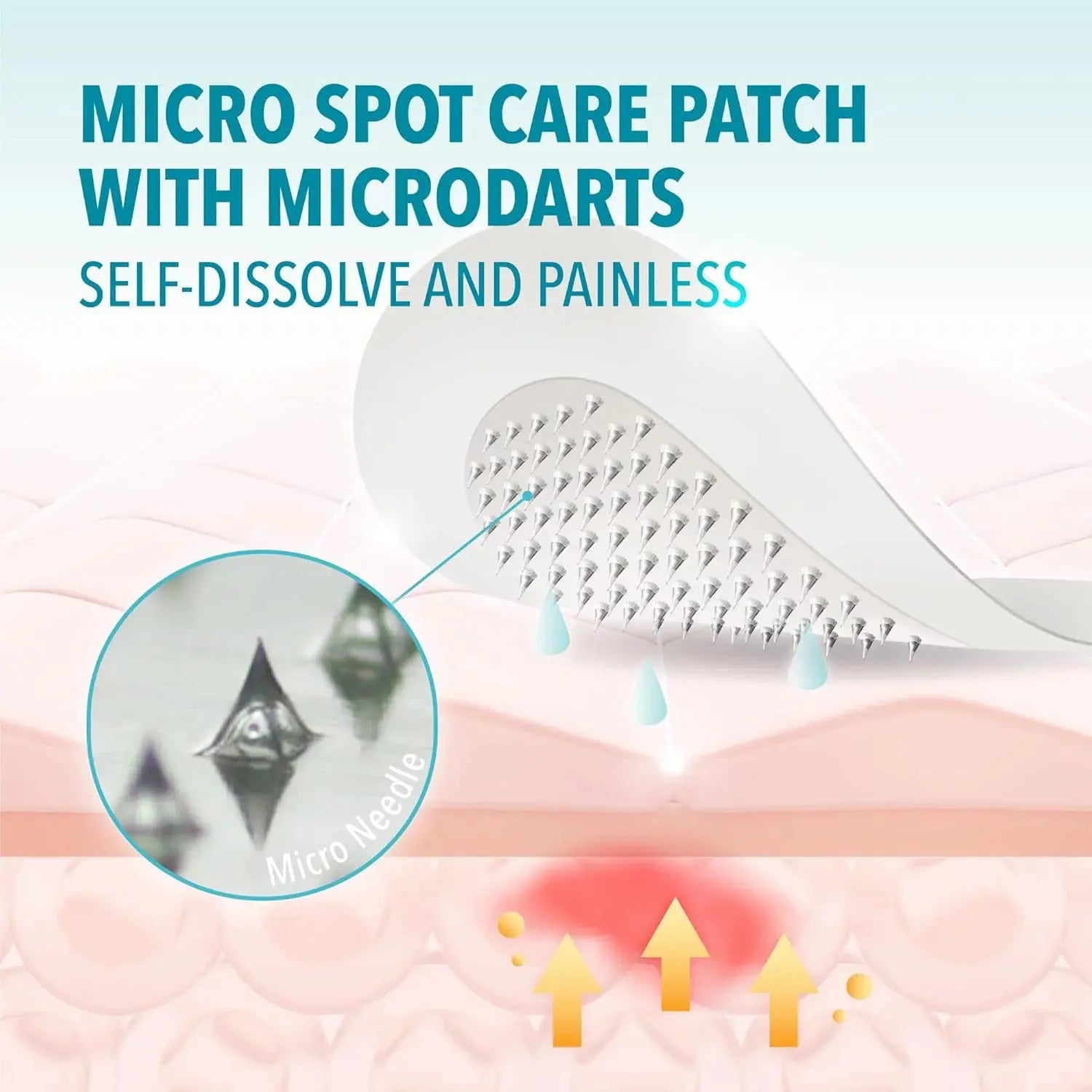 Nano microneedle patch with microdot needle pattern on a flexible patch
